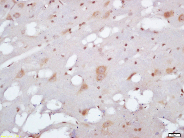 EXOC2/SEC5 Antibody in Immunohistochemistry (Paraffin) (IHC (P))