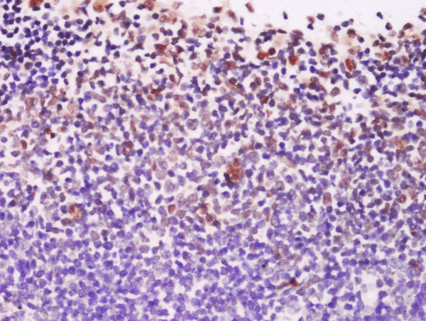 EXOSC10/PMSCL2 Antibody in Immunohistochemistry (Paraffin) (IHC (P))