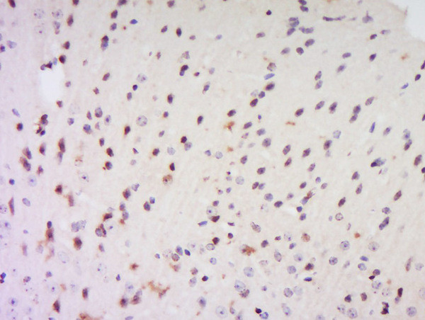 EXOSC7 Antibody in Immunohistochemistry (Paraffin) (IHC (P))