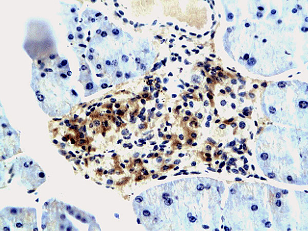 IGF2BP3 Antibody in Immunohistochemistry (Paraffin) (IHC (P))