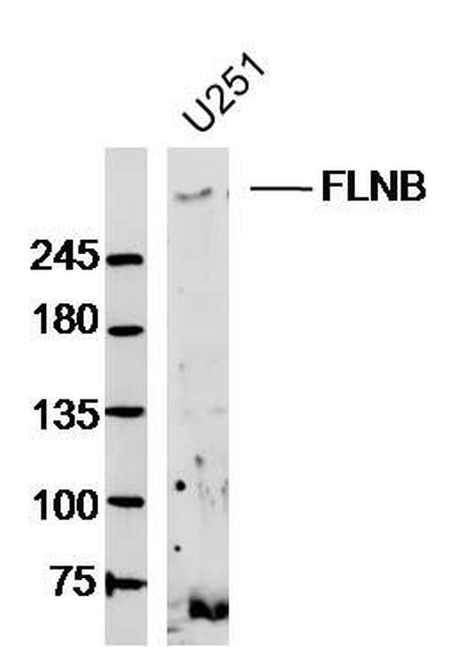 FLNB/Filamin 3 Antibody in Western Blot (WB)