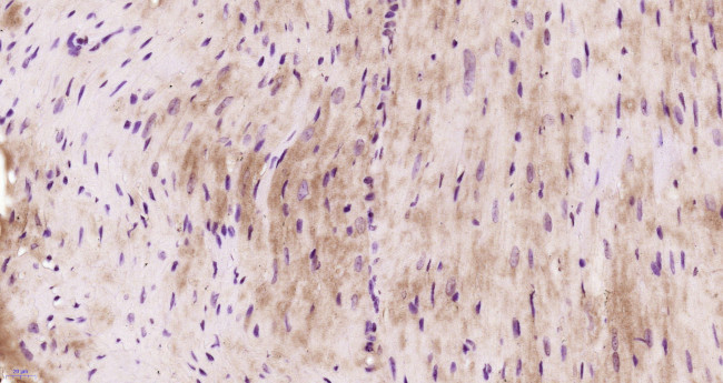 Filamin 2 Antibody in Immunohistochemistry (Paraffin) (IHC (P))
