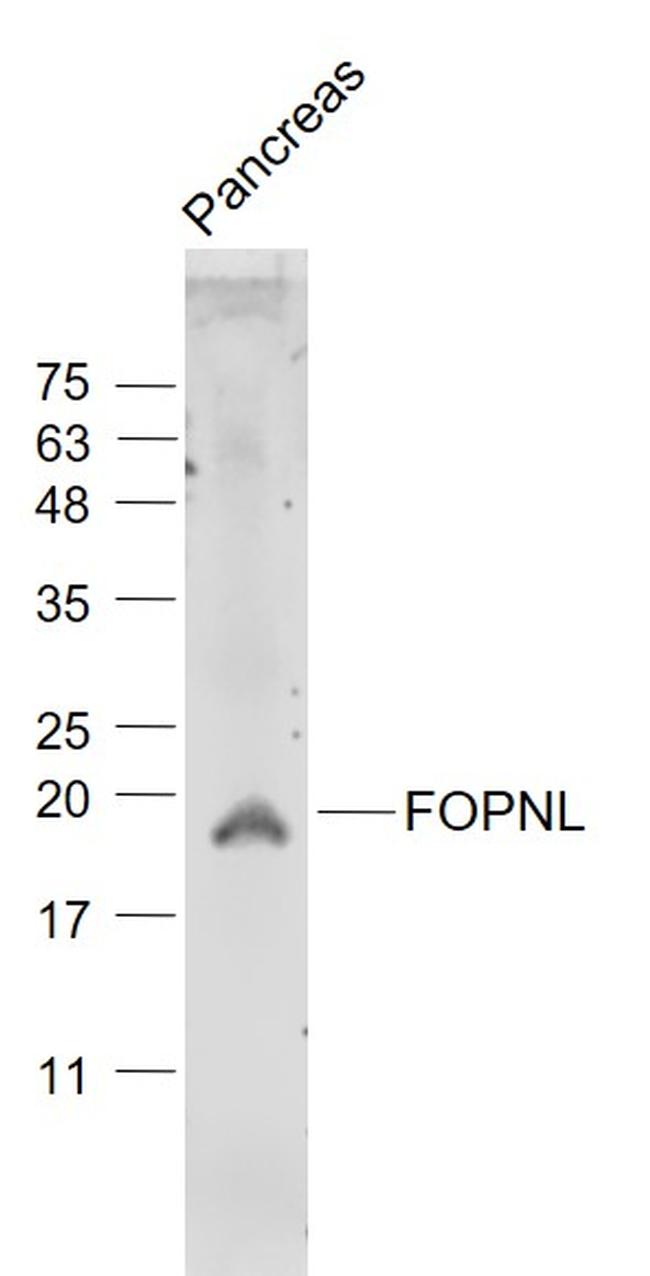FOPNL/C16orf63 Antibody in Western Blot (WB)