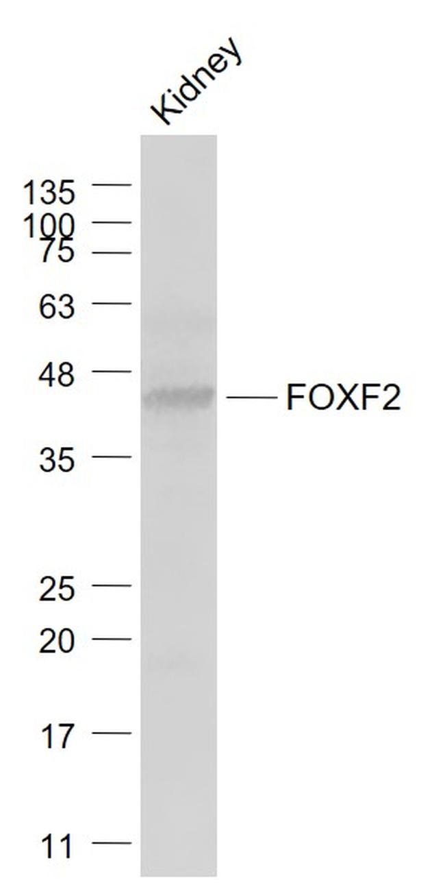 FOXF2 Antibody in Western Blot (WB)