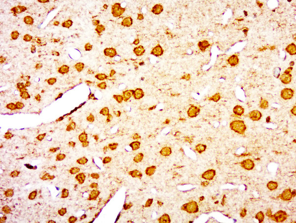 FOXRED1 Antibody in Immunohistochemistry (Paraffin) (IHC (P))