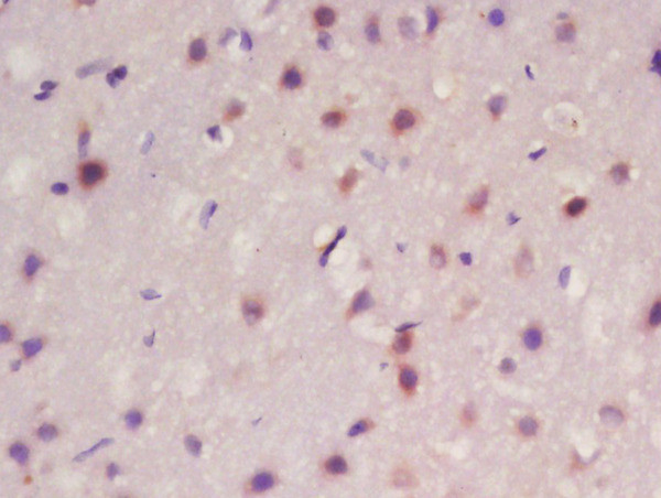 Frizzled 10/CD350 Antibody in Immunohistochemistry (Paraffin) (IHC (P))