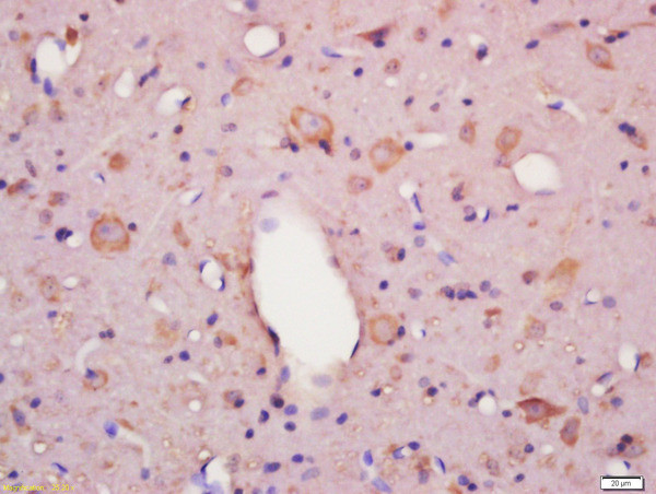 Frizzled 6 Antibody in Immunohistochemistry (Paraffin) (IHC (P))