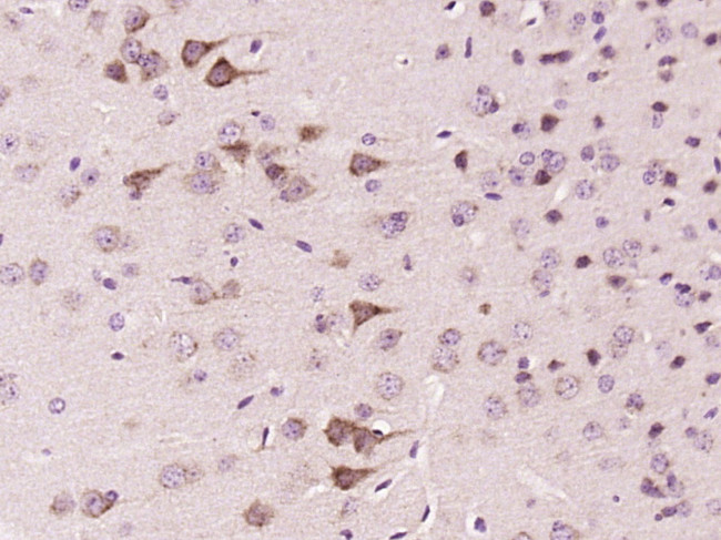 FSD1 Antibody in Immunohistochemistry (Paraffin) (IHC (P))