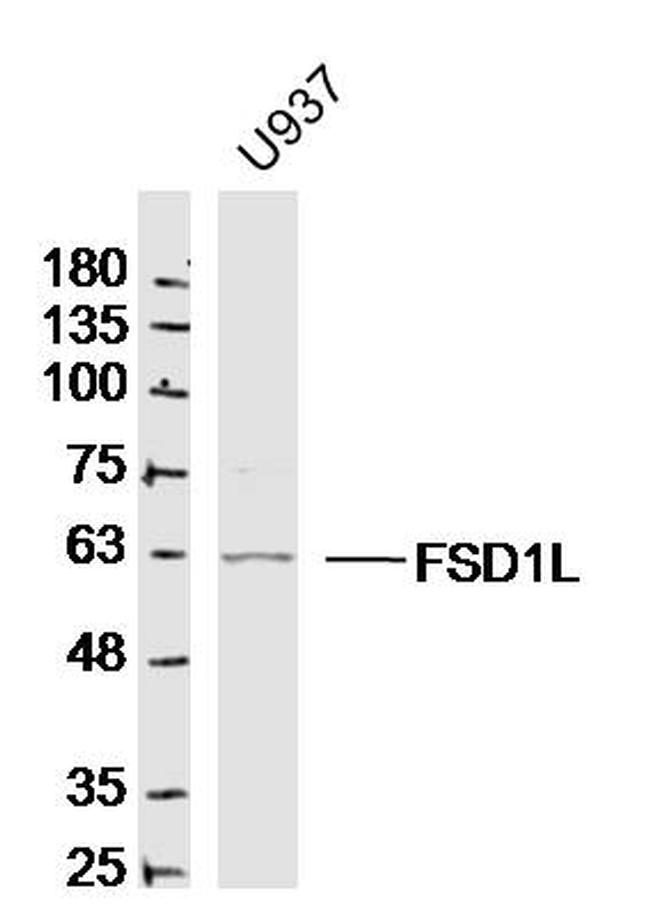 FSD1L/CCDC10 Antibody in Western Blot (WB)