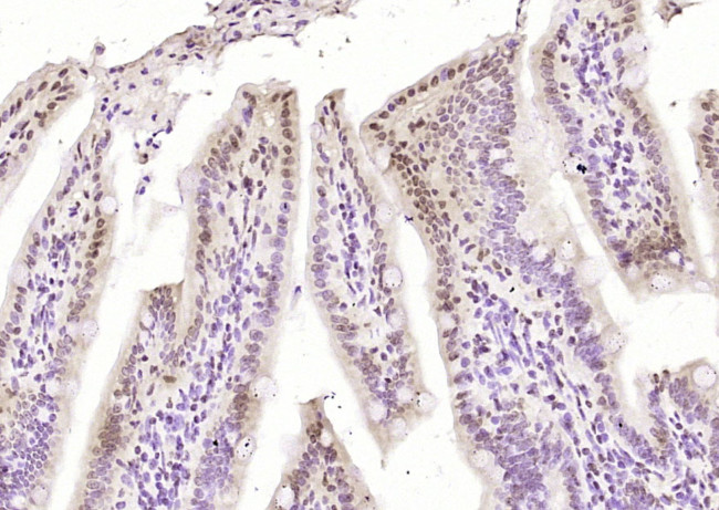 FUBP1/2 Antibody in Immunohistochemistry (Paraffin) (IHC (P))