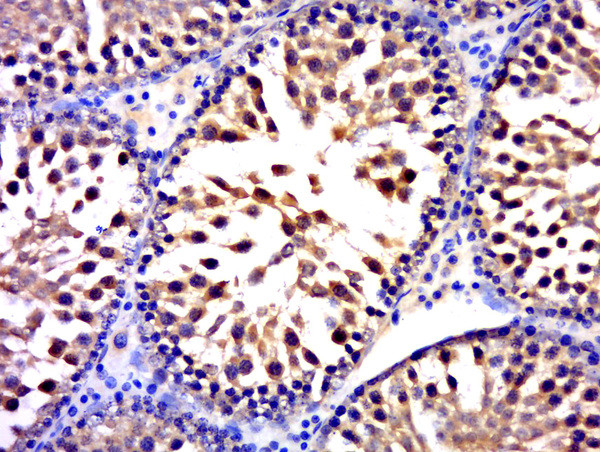 FUSIP1 Antibody in Immunohistochemistry (Paraffin) (IHC (P))