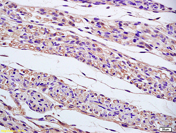 gamma tubulin Centrosome Marker Antibody in Immunohistochemistry (Paraffin) (IHC (P))