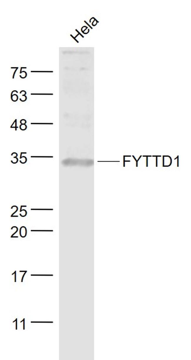 FYTTD1 Antibody in Western Blot (WB)