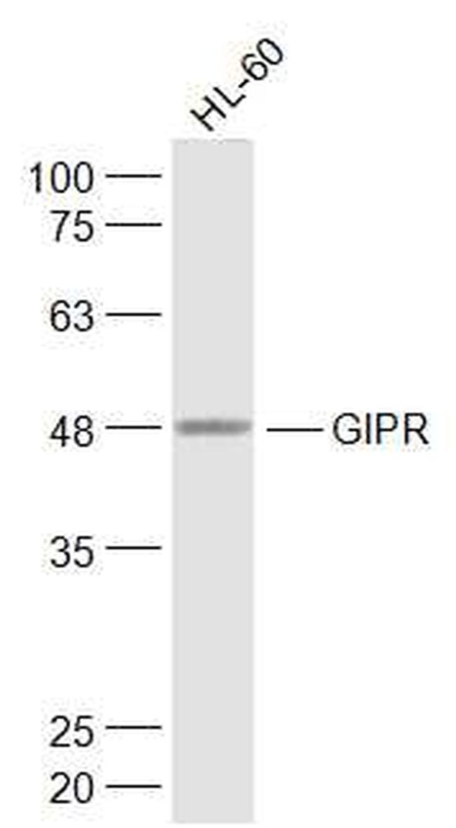 GIPR Antibody in Western Blot (WB)