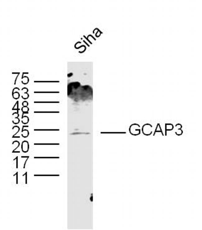 GCAP3 Antibody in Western Blot (WB)