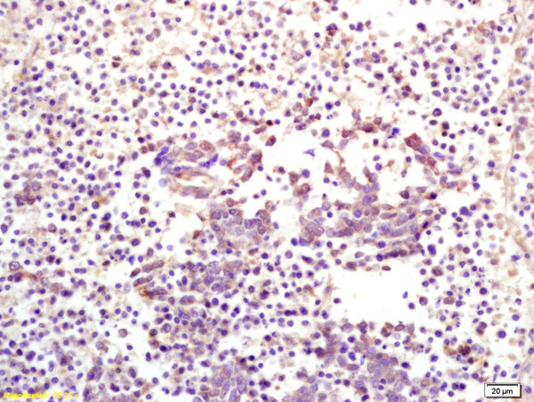 CKIP-1 Antibody in Immunohistochemistry (Paraffin) (IHC (P))