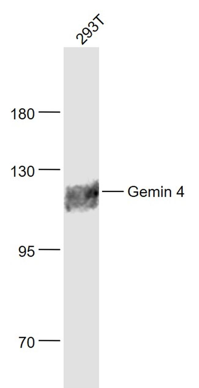 Gemin 4 Antibody in Western Blot (WB)
