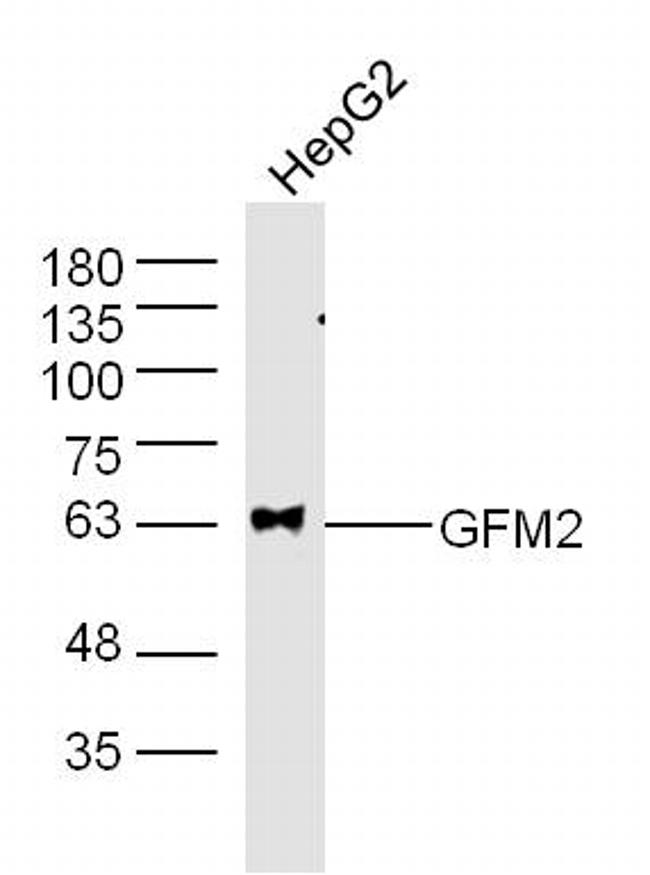 GFM2 Antibody in Western Blot (WB)