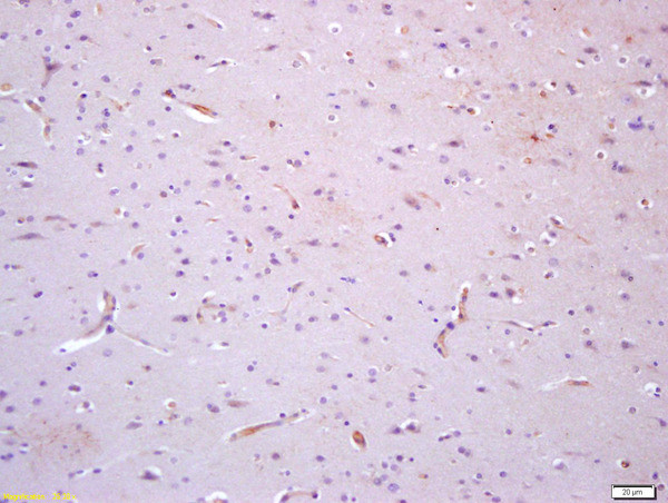 TIE1 Antibody in Immunohistochemistry (Paraffin) (IHC (P))