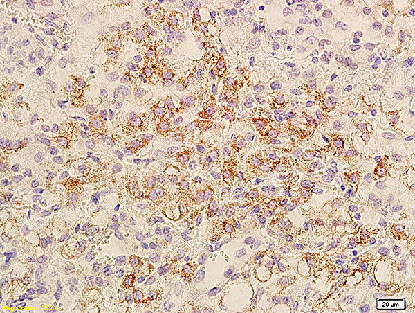 BCL2L1 Antibody in Immunohistochemistry (Paraffin) (IHC (P))