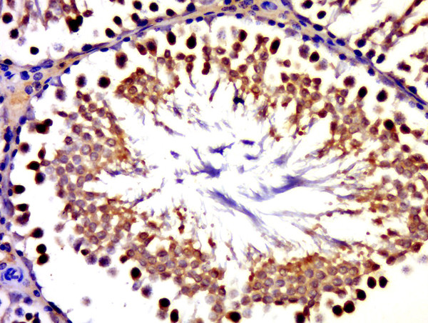 GLE1 Antibody in Immunohistochemistry (Paraffin) (IHC (P))
