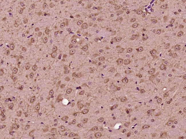 GLT25D2 Antibody in Immunohistochemistry (Paraffin) (IHC (P))