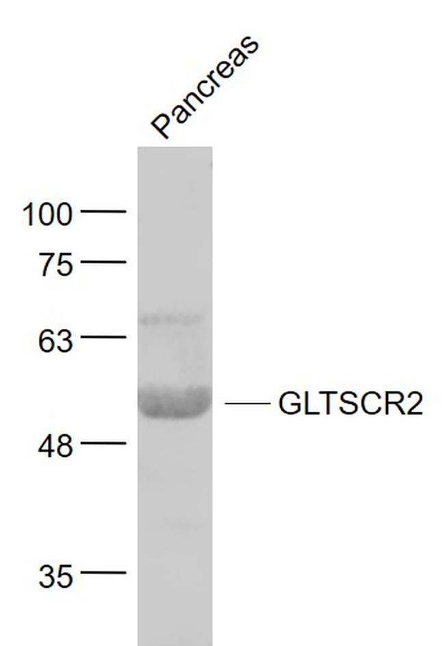 GLTSCR2/PICT1 Antibody in Western Blot (WB)