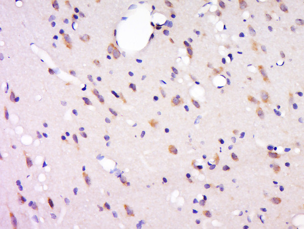 Phospho-GluR1 (Thr856) Antibody in Immunohistochemistry (Paraffin) (IHC (P))