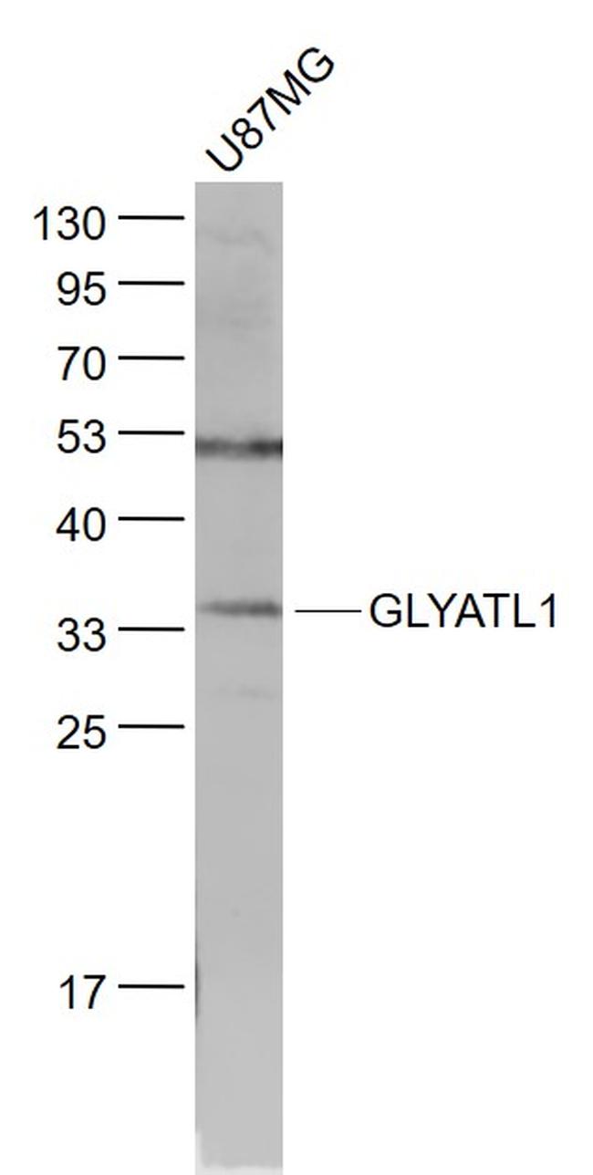 GLYATL1 Antibody in Western Blot (WB)
