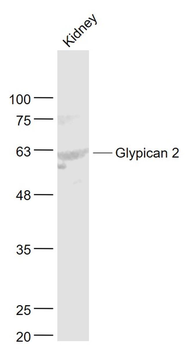 Glypican 2/GPC2 Antibody in Western Blot (WB)