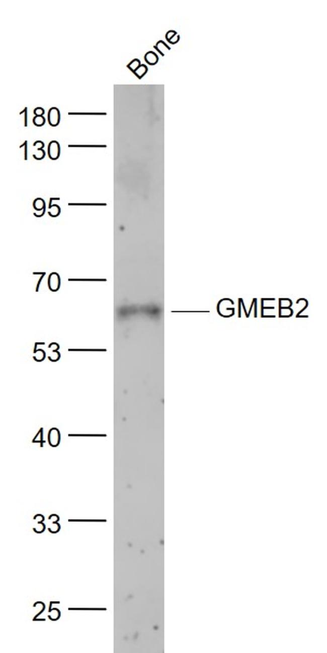 GMEB2 Antibody in Western Blot (WB)