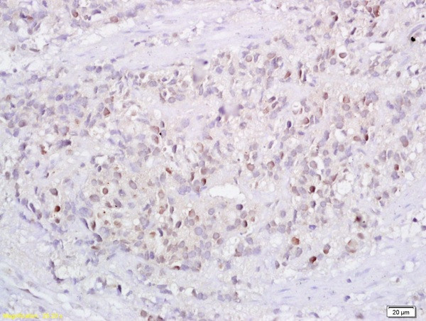 Tp73 protein Antibody in Immunohistochemistry (Paraffin) (IHC (P))