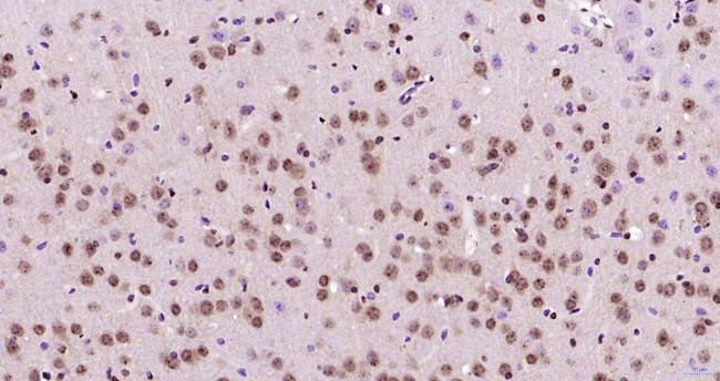 GNL3L Antibody in Immunohistochemistry (Paraffin) (IHC (P))