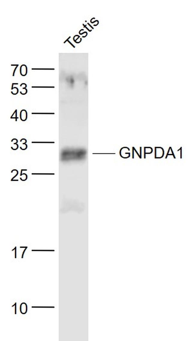 GNPDA1 Antibody in Western Blot (WB)