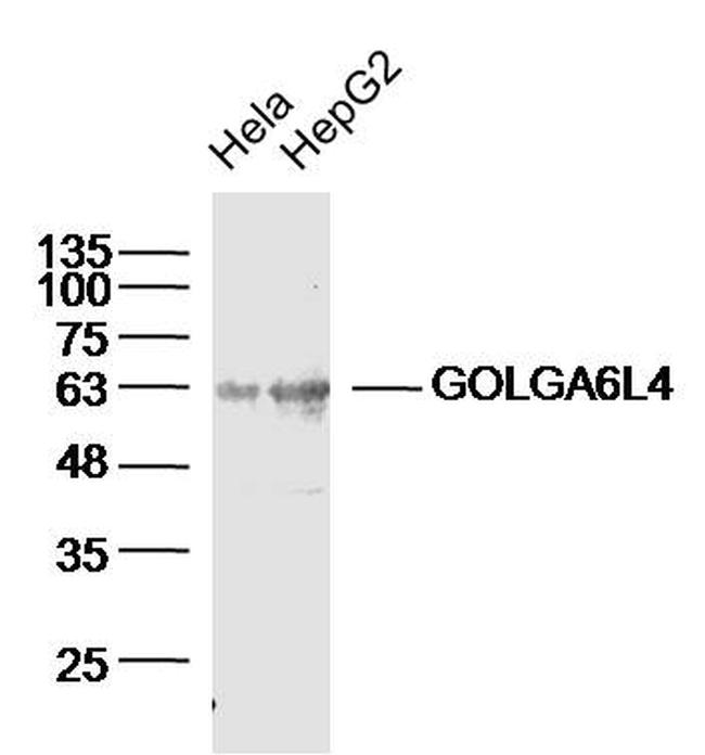 GOLGA6L4 Antibody in Western Blot (WB)