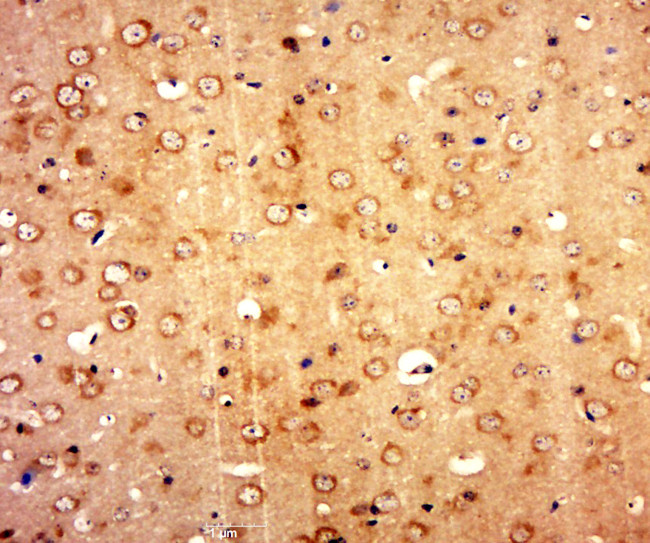 Golgi phosphoprotein 6 Antibody in Immunohistochemistry (Paraffin) (IHC (P))