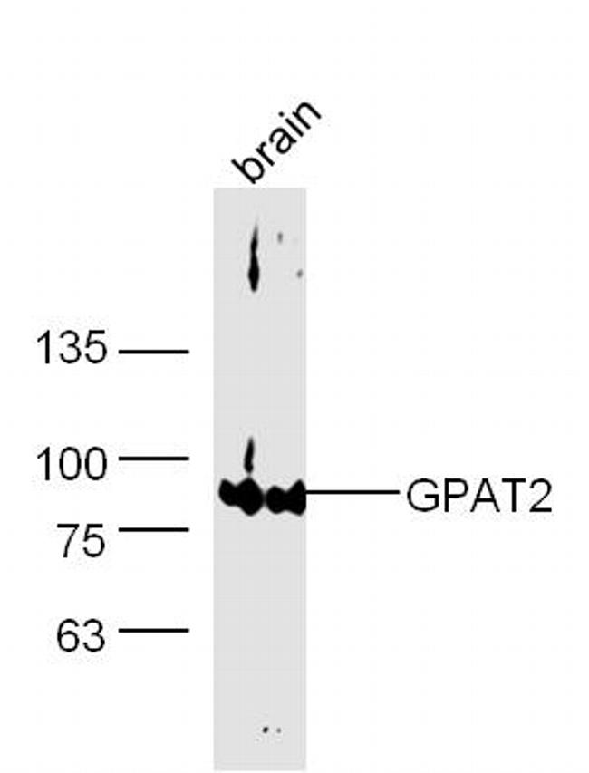 GPAT2 Antibody in Western Blot (WB)