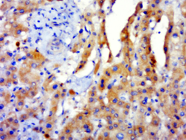 GPATCH3 Antibody in Immunohistochemistry (Paraffin) (IHC (P))