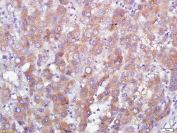GPR110 Antibody in Immunohistochemistry (Paraffin) (IHC (P))