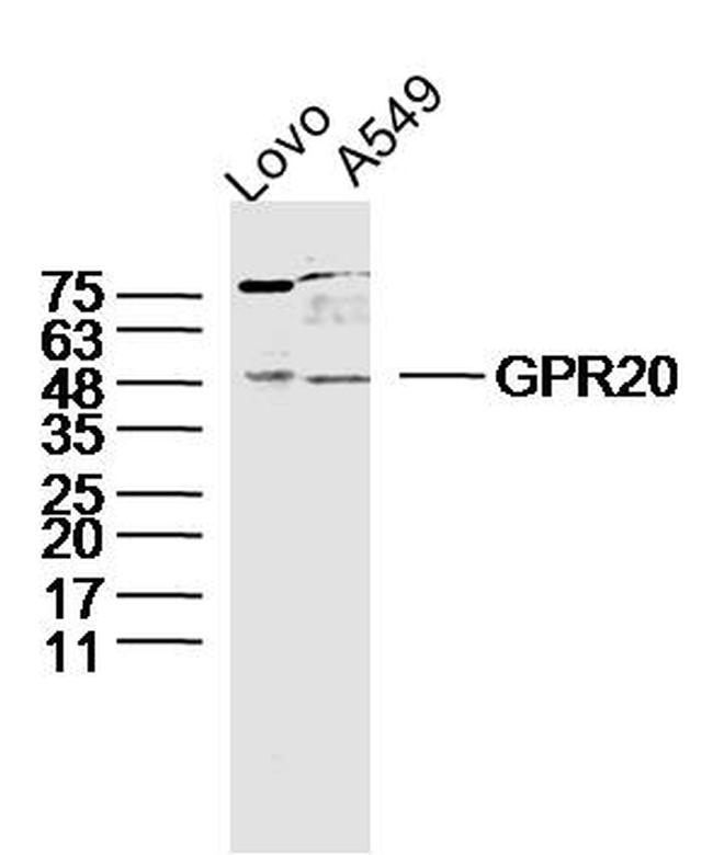 GPR20 Antibody in Western Blot (WB)