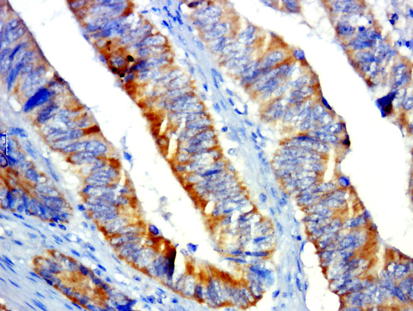 GPR31 Antibody in Immunohistochemistry (Paraffin) (IHC (P))