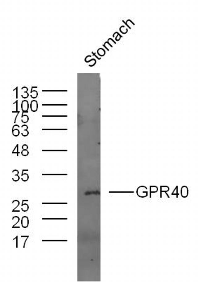 GPR40 Antibody in Western Blot (WB)
