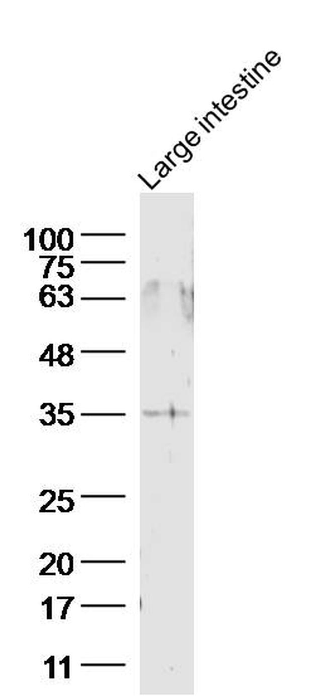 GPR45 Antibody in Western Blot (WB)