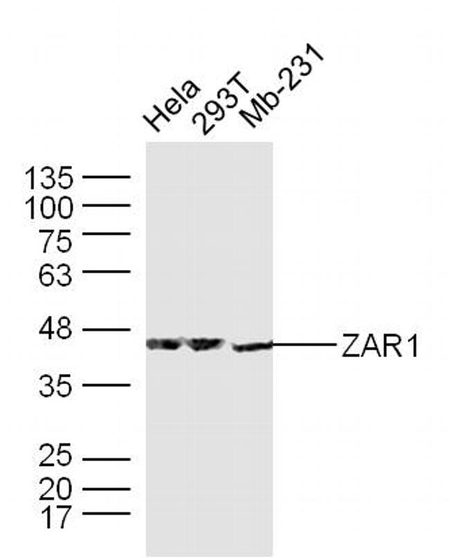 ZAR1/Zygote arrest protein 1 Antibody in Western Blot (WB)