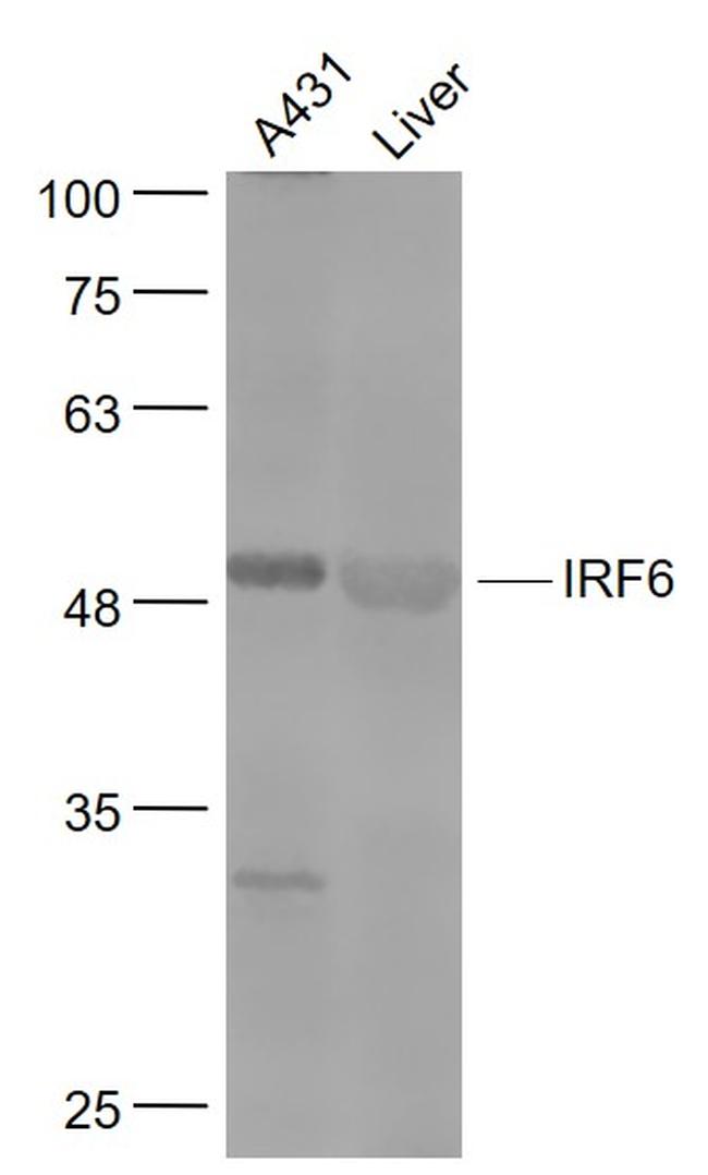IRF6 Antibody in Western Blot (WB)