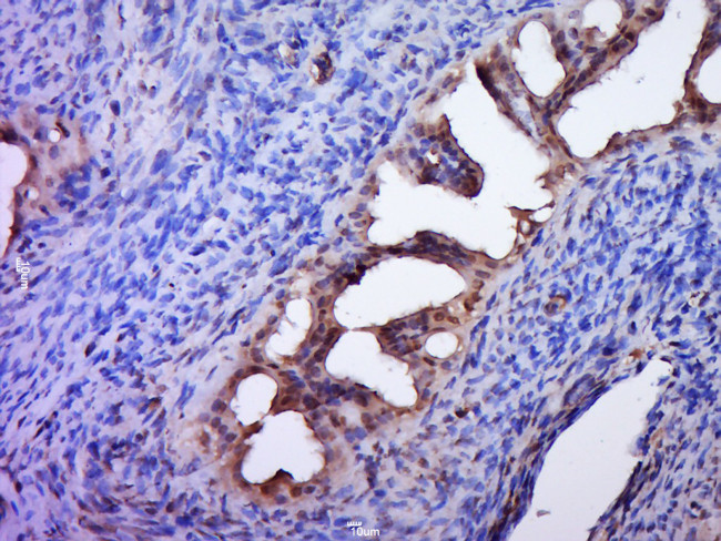 DZIP1 Antibody in Immunohistochemistry (Paraffin) (IHC (P))
