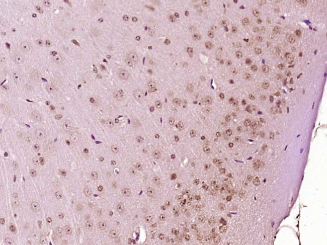 GADD45 Antibody in Immunohistochemistry (Paraffin) (IHC (P))