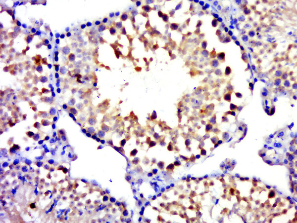 MYCBPAP Antibody in Immunohistochemistry (Paraffin) (IHC (P))