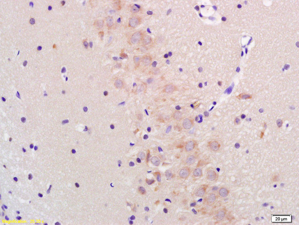 GADD153/DDIT3 Antibody in Immunohistochemistry (Paraffin) (IHC (P))