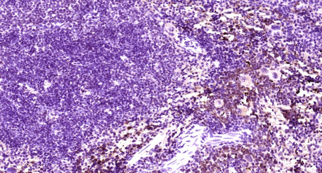 CLEC9A Antibody in Immunohistochemistry (Paraffin) (IHC (P))